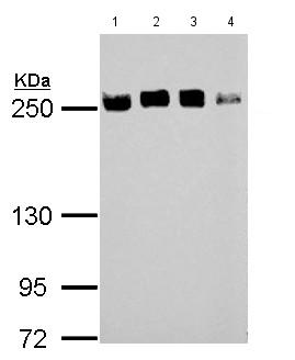 Western blot - Anti-eIF4GII antibody - N-terminal (AB155482), expandable thumbnail