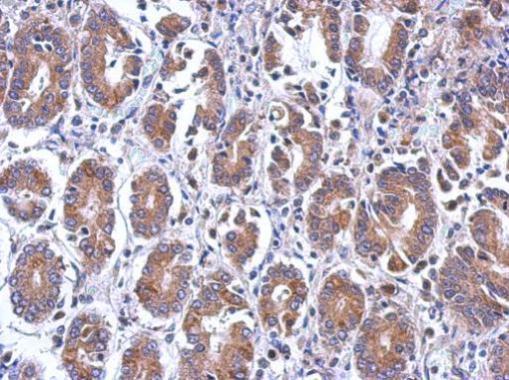 Immunohistochemistry (Formalin/PFA-fixed paraffin-embedded sections) - Anti-EIF5 antibody (AB228874)