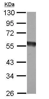 Western blot - Anti-EIF5 antibody (AB228874)