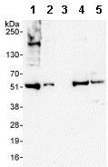 Western blot - Anti-EIF5 antibody (AB85913), expandable thumbnail