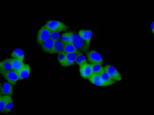 Immunocytochemistry/ Immunofluorescence - Anti-EIF5 antibody [EPR12140(B)] - BSA and Azide free (AB249587)