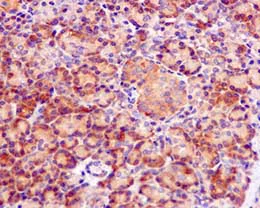 Immunohistochemistry (Formalin/PFA-fixed paraffin-embedded sections) - Anti-EIF5 antibody [EPR12140(B)] - BSA and Azide free (AB249587)