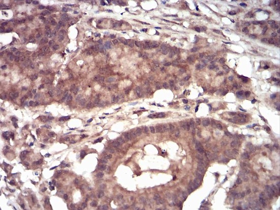 Immunohistochemistry (Formalin/PFA-fixed paraffin-embedded sections) - Anti-eIF5A antibody [4E10F6] (AB204939), expandable thumbnail