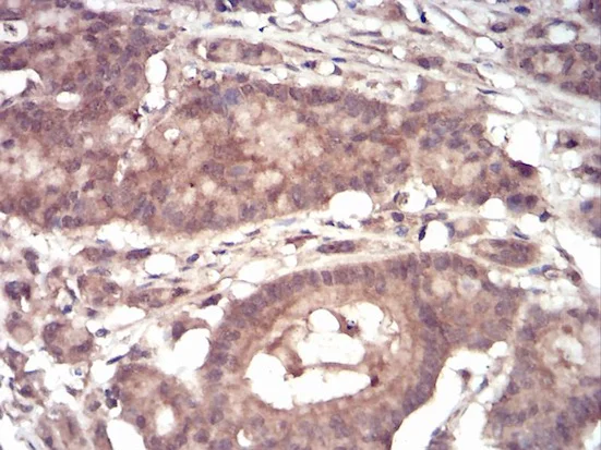 Immunohistochemistry (Formalin/PFA-fixed paraffin-embedded sections) - Anti-eIF5A antibody [4E10F6] (AB204939)