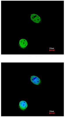 Immunocytochemistry/ Immunofluorescence - Anti-eIF5A antibody (AB137561), expandable thumbnail