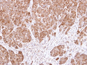 Immunohistochemistry (Formalin/PFA-fixed paraffin-embedded sections) - Anti-eIF5A antibody (AB137561), expandable thumbnail