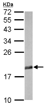 Western blot - Anti-eIF5A antibody (AB137561), expandable thumbnail