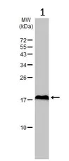 Western blot - Anti-eIF5A antibody (AB137561)