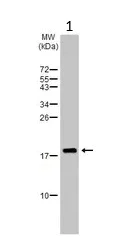 Western blot - Anti-eIF5A antibody (AB137561)