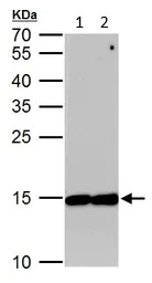 Western blot - Anti-eIF5A antibody (AB137561)