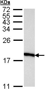 Western blot - Anti-eIF5A antibody (AB137561), expandable thumbnail