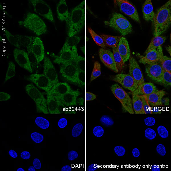 Immunocytochemistry/ Immunofluorescence - Anti-eIF5A antibody [EP526Y] (AB32443)