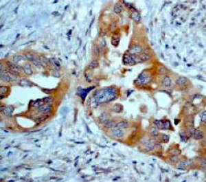 Immunohistochemistry (Formalin/PFA-fixed paraffin-embedded sections) - Anti-eIF5A antibody [EP526Y] (AB32443)