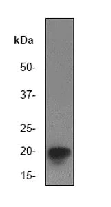 Western blot - Anti-eIF5A antibody [EP526Y] (AB32443)