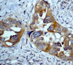 Immunohistochemistry (Formalin/PFA-fixed paraffin-embedded sections) - Anti-eIF5A antibody [EP526Y] - BSA and Azide free (AB239816), expandable thumbnail
