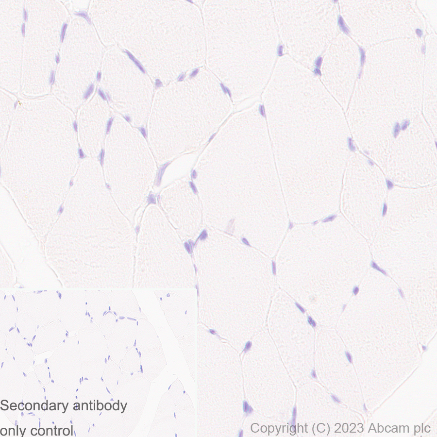 Immunohistochemistry (Formalin/PFA-fixed paraffin-embedded sections) - Anti-eIF5A antibody [EP526Y] - BSA and Azide free (ab239816), expandable thumbnail