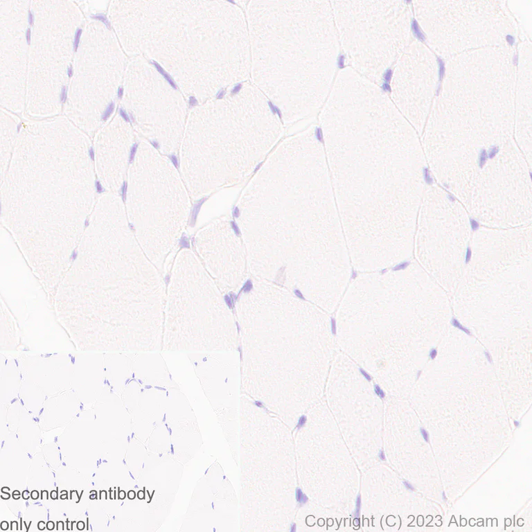 Immunohistochemistry (Formalin/PFA-fixed paraffin-embedded sections) - Anti-eIF5A antibody [EP526Y] - BSA and Azide free (AB239816)