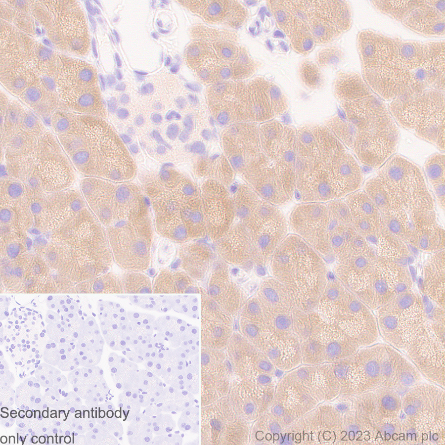 Immunohistochemistry (Formalin/PFA-fixed paraffin-embedded sections) - Anti-eIF5A antibody [EP526Y] - BSA and Azide free (AB239816), expandable thumbnail