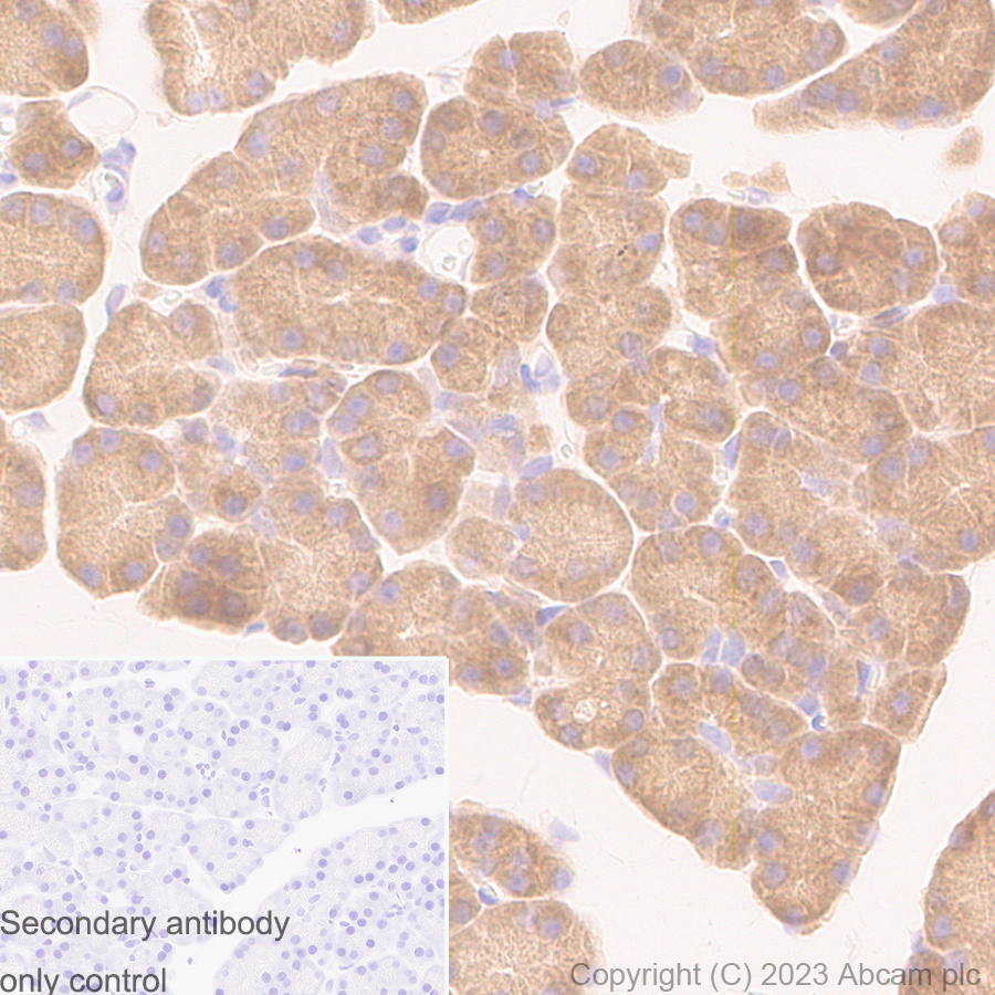 Immunohistochemistry (Formalin/PFA-fixed paraffin-embedded sections) - Anti-eIF5A antibody [EP526Y] - BSA and Azide free (ab239816), expandable thumbnail