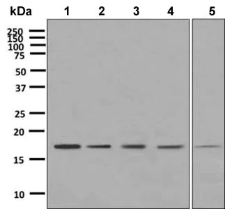 Western blot - Anti-eIF5A2 + eIF5A antibody [EPR7411-105] (AB150403)