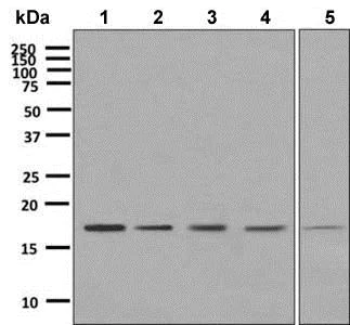 Western blot - Anti-eIF5A2 + eIF5A antibody [EPR7411-105] - BSA and Azide free (AB248971)