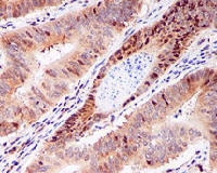 Immunohistochemistry (Formalin/PFA-fixed paraffin-embedded sections) - Anti-eIF5A2 + eIF5A antibody [EPR7411-6] (AB126735), expandable thumbnail