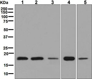 Western blot - Anti-eIF5A2 + eIF5A antibody [EPR7411-6] (AB126735), expandable thumbnail