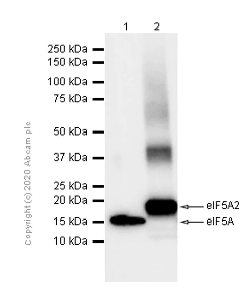 Western blot - Anti-eIF5A2 + eIF5A antibody [EPR7411-6] (AB126735)