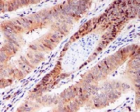 Immunohistochemistry (Formalin/PFA-fixed paraffin-embedded sections) - Anti-eIF5A2 + eIF5A antibody [EPR7411-6] - BSA and Azide free (AB248154)