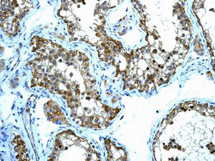 Immunohistochemistry (Formalin/PFA-fixed paraffin-embedded sections) - Anti-eIF5A2 + eIF5A antibody [EPR7412-47] (AB126733), expandable thumbnail