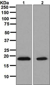Western blot - Anti-eIF5A2 + eIF5A antibody [EPR7412-47] (AB126733), expandable thumbnail