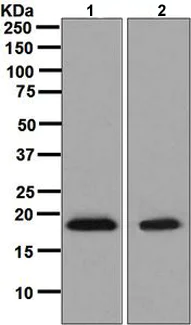 Western blot - Anti-eIF5A2 + eIF5A antibody [EPR7412-47] (AB126733)