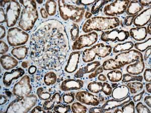 Immunohistochemistry (Formalin/PFA-fixed paraffin-embedded sections) - Anti-eIF5A2 + eIF5A antibody [EPR7412-50] (ab150439), expandable thumbnail
