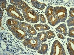 Immunohistochemistry (Formalin/PFA-fixed paraffin-embedded sections) - Anti-eIF5A2 + eIF5A antibody [EPR7412-50] (AB150439)