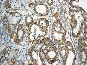 Immunohistochemistry (Formalin/PFA-fixed paraffin-embedded sections) - Anti-eIF5A2 + eIF5A antibody [EPR7412-50] (AB150439)
