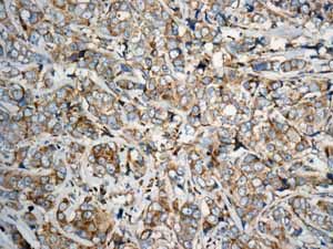 Immunohistochemistry (Formalin/PFA-fixed paraffin-embedded sections) - Anti-eIF5A2 + eIF5A antibody [EPR7412-50] (AB150439), expandable thumbnail