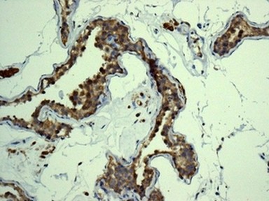 Immunohistochemistry (Formalin/PFA-fixed paraffin-embedded sections) - Anti-eIF5A2 + eIF5A antibody [EPR7412-50] (AB150439), expandable thumbnail
