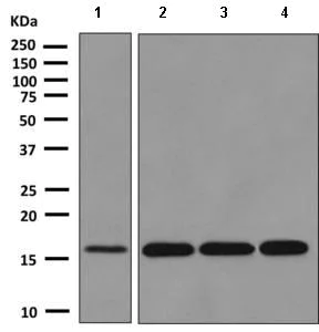 Western blot - Anti-eIF5A2 + eIF5A antibody [EPR7412-50] (AB150439)