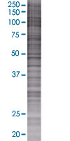 eIF5A2 overexpression 293T lysate (whole cell)