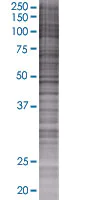 SDS-PAGE - eIF5A2 overexpression 293T lysate (whole cell) (AB94210)