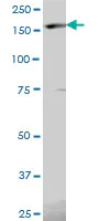 Western blot - Anti-EIF5B antibody (AB89016)