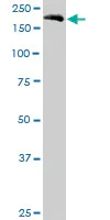 Western blot - Anti-EIF5B antibody (AB89016)