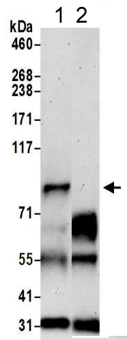 Immunoprecipitation - Anti-ELAC2 antibody (AB205948)