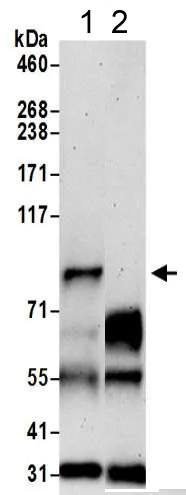 Immunoprecipitation - Anti-ELAC2 antibody (AB205948)