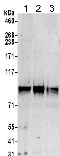 Western blot - Anti-ELAC2 antibody (AB205948)