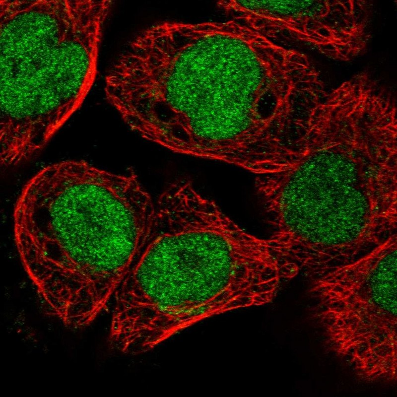 Immunocytochemistry/ Immunofluorescence - Anti-ELAC2 antibody (ab251725), expandable thumbnail