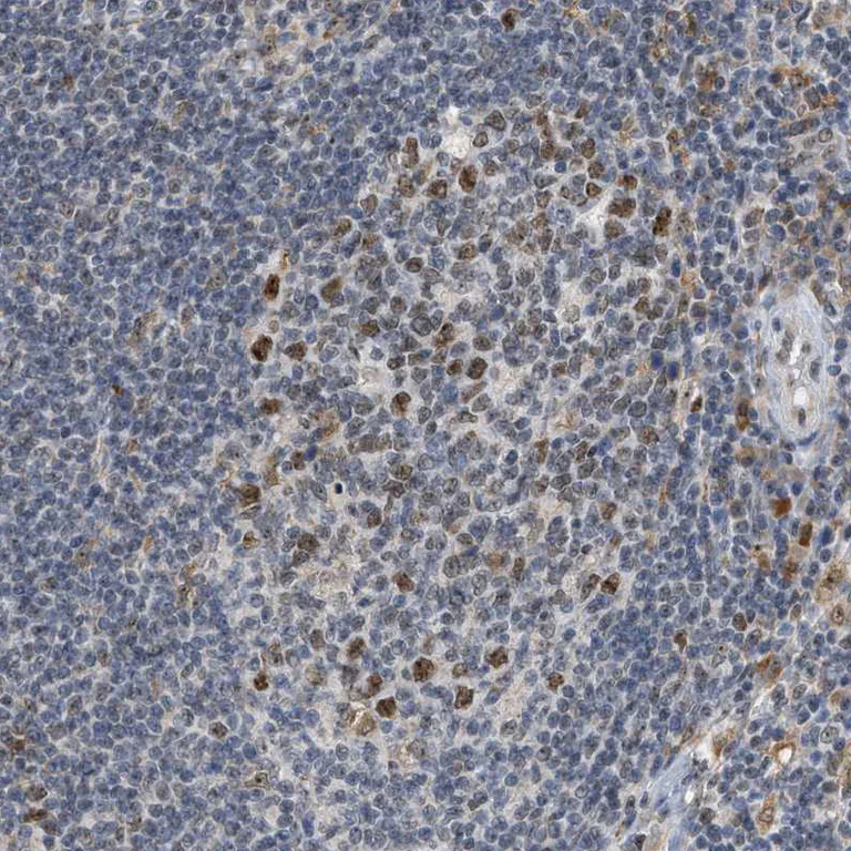 Immunohistochemistry (Formalin/PFA-fixed paraffin-embedded sections) - Anti-ELAC2 antibody (AB251725)