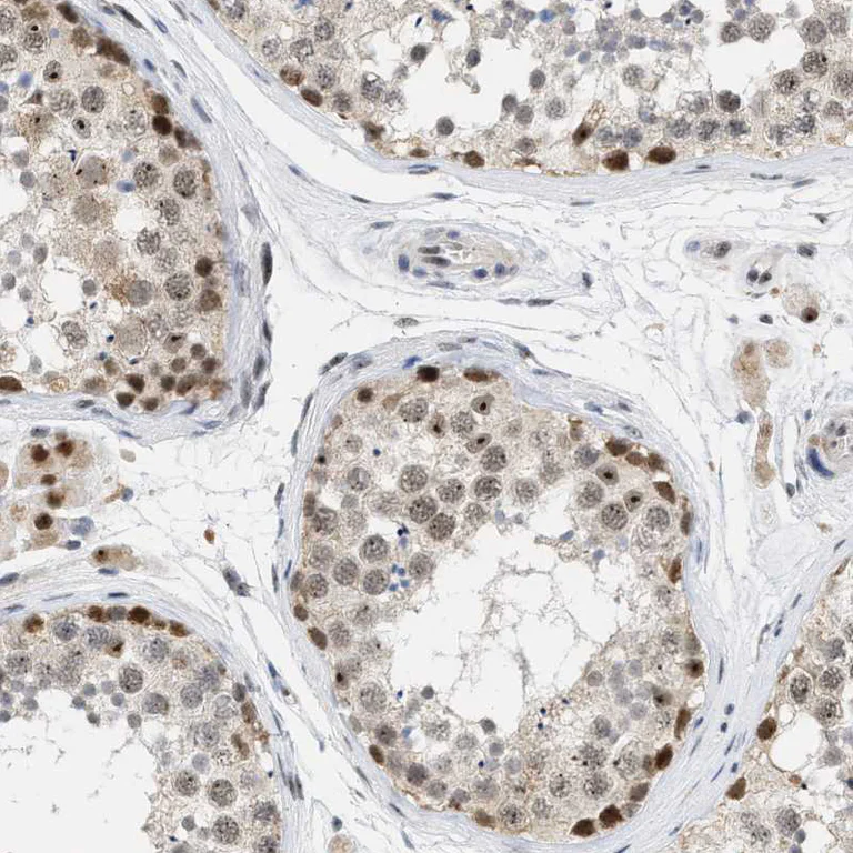 Immunohistochemistry (Formalin/PFA-fixed paraffin-embedded sections) - Anti-ELAC2 antibody (AB251725)