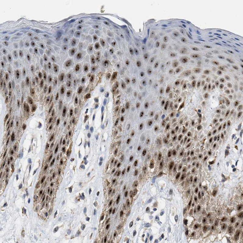 Immunohistochemistry (Formalin/PFA-fixed paraffin-embedded sections) - Anti-ELAC2 antibody (AB251725), expandable thumbnail