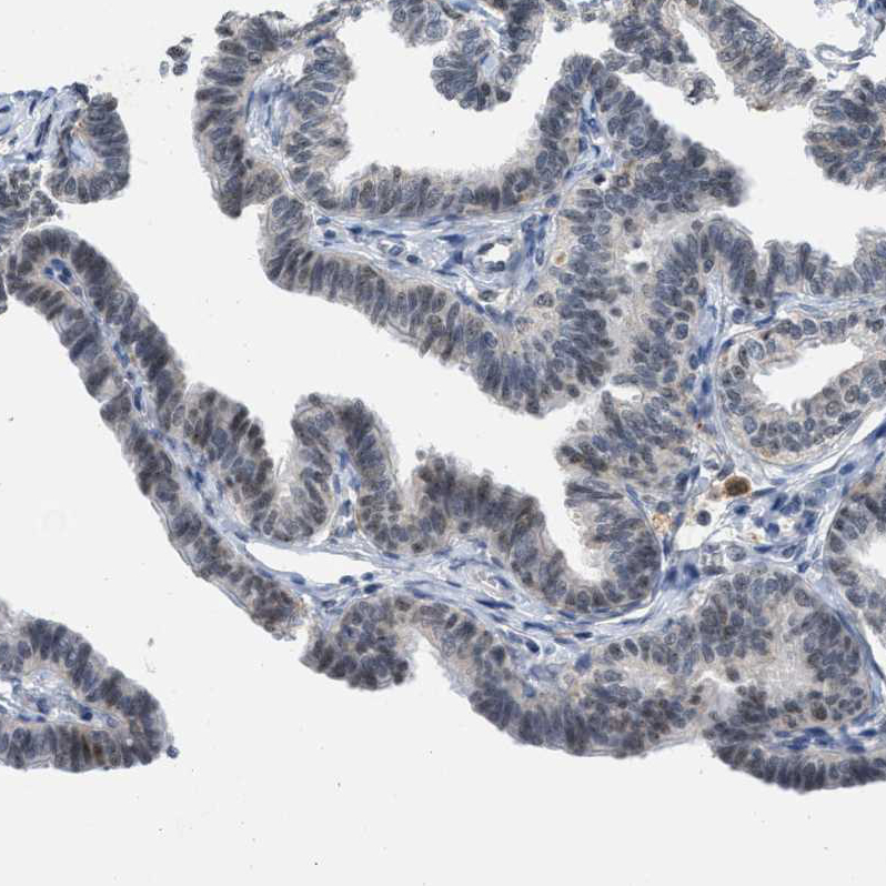 Immunohistochemistry (Formalin/PFA-fixed paraffin-embedded sections) - Anti-ELAC2 antibody (AB251725), expandable thumbnail